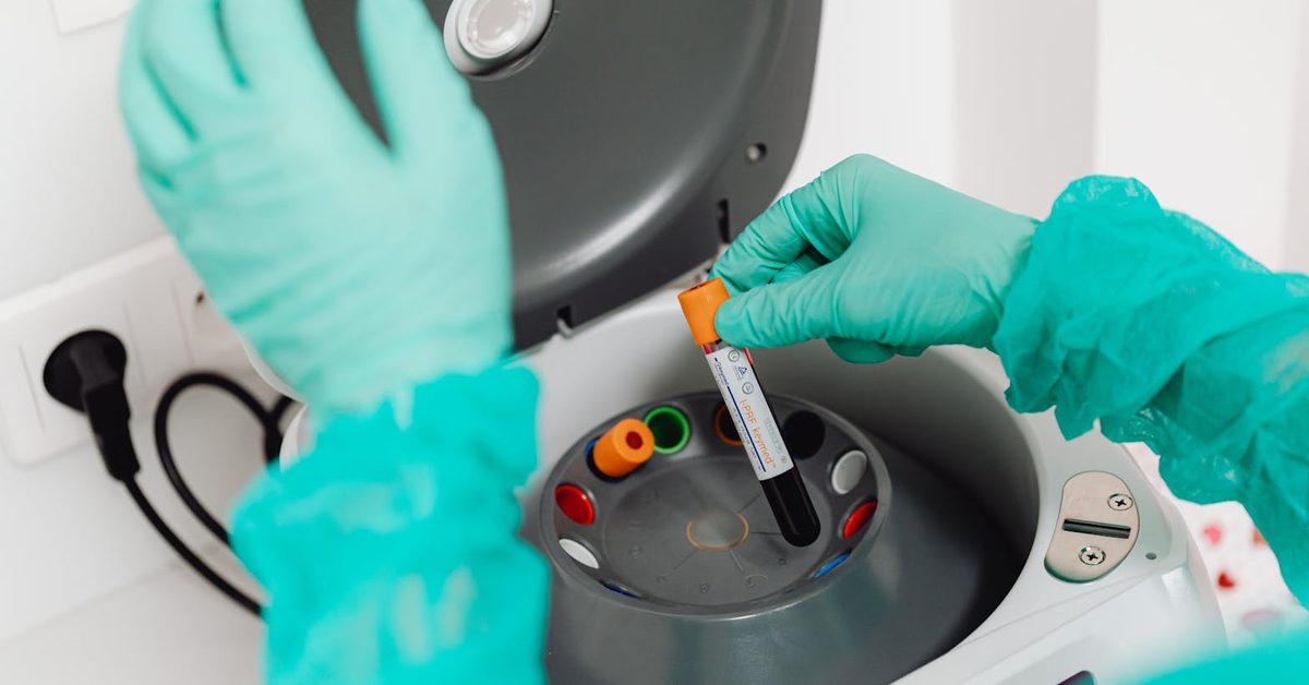Técnica de laboratório manipulando amostras de sangue para análise