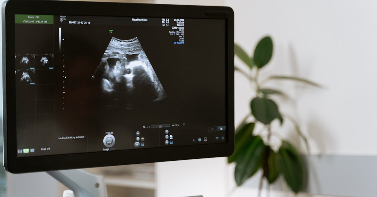 Tela de ultrassom mostrando exame obstétrico para diagnóstico